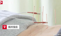 针灸视频,入门到精通的实用指南